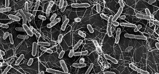 Salmonellae (image from an electron microscope)