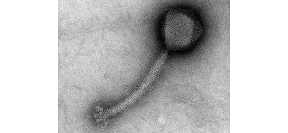 Staphylococcus aureus bacteriophage (photograph courtesy of J. Klumpp)